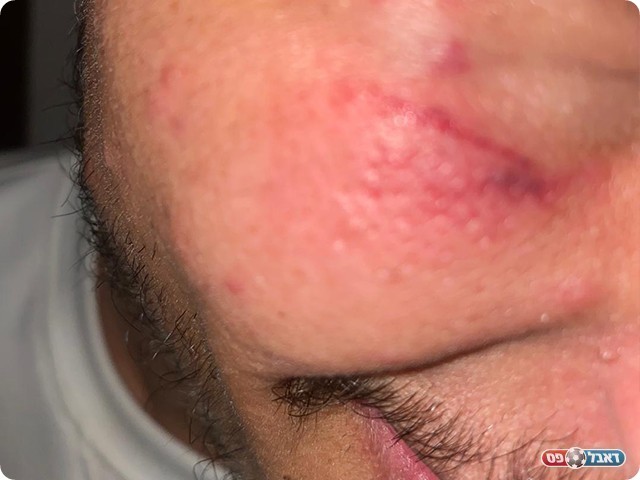 (דף הפייסבוק הפועל באקה אל גרבייה)